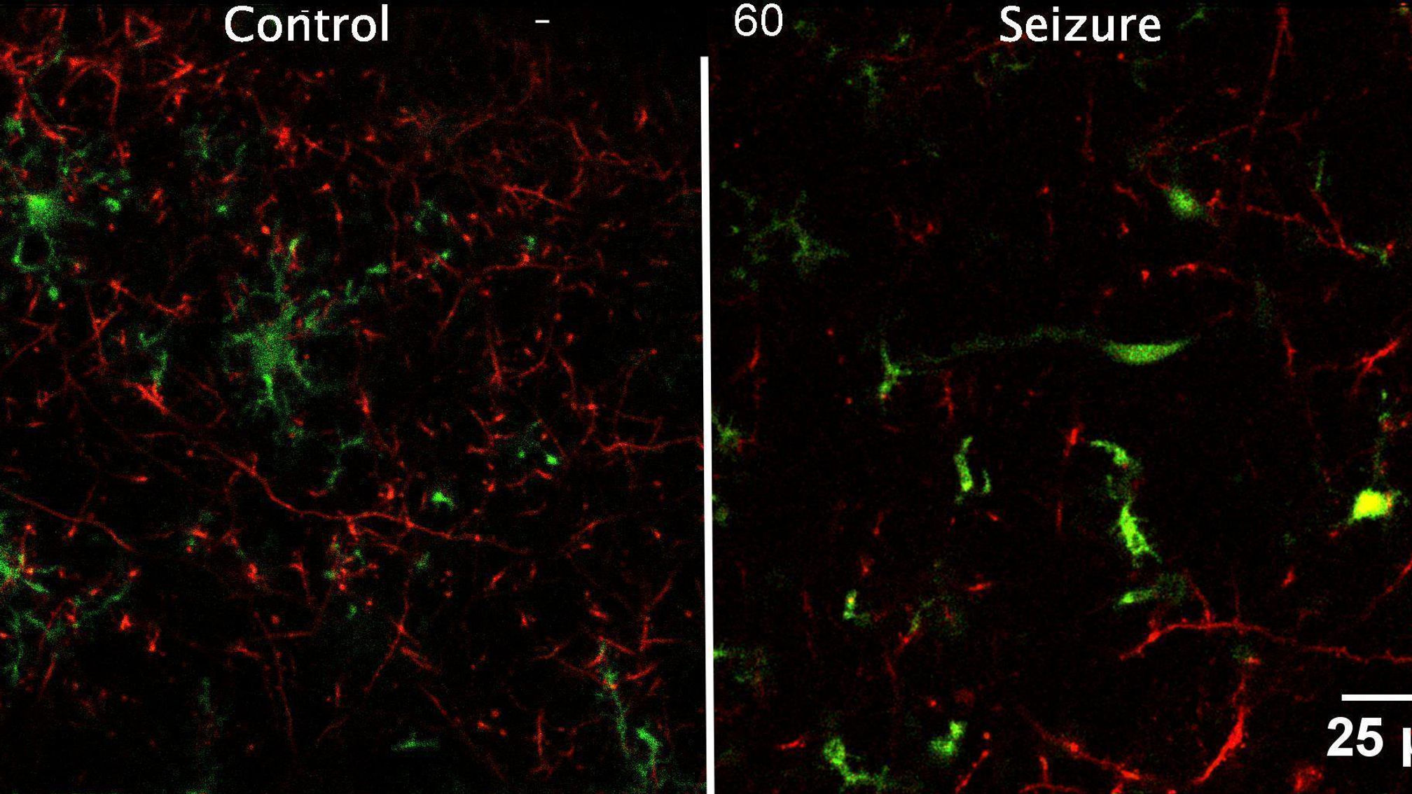 Microglial Process Pouches Target Beaded Dendrites After Seizures